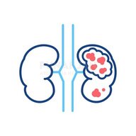 kidneycancer